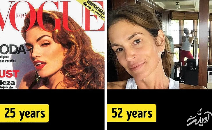 چهره‌های معروفی که هیچ جراحی زیبایی نکرده‌اند